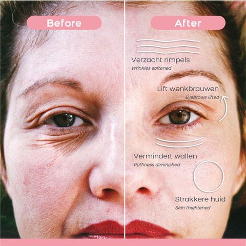 Dermawand Original